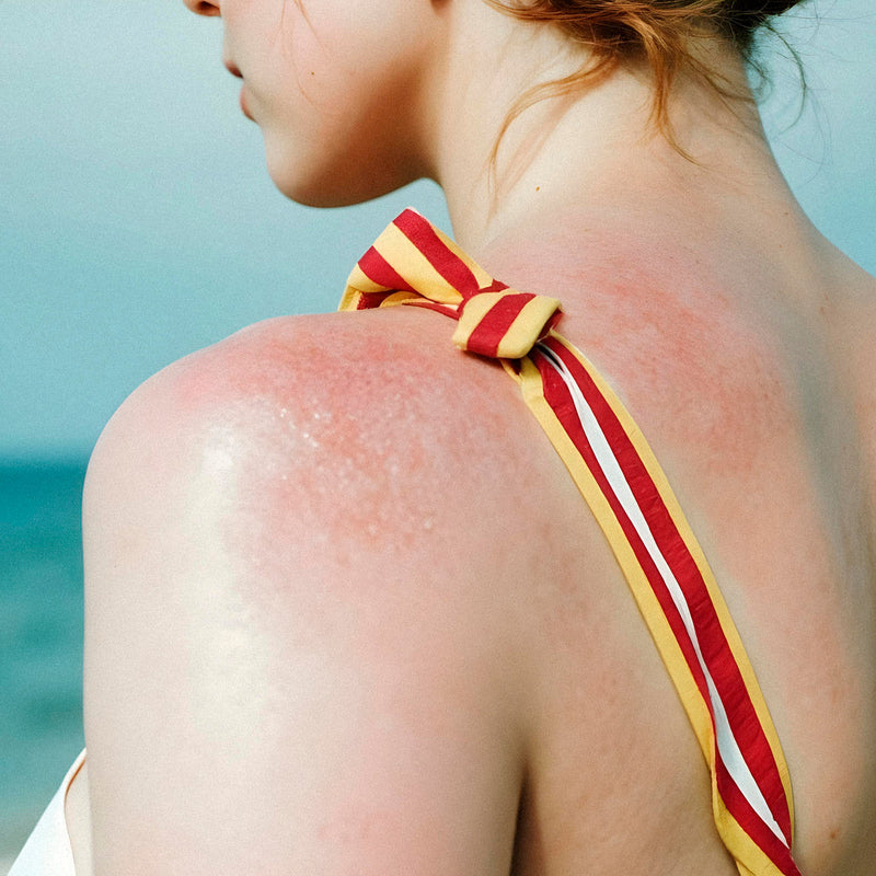 plaques rouges sur le corps