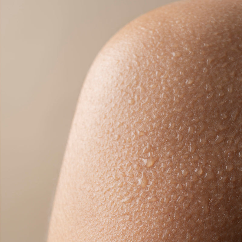 boutons sur les bras