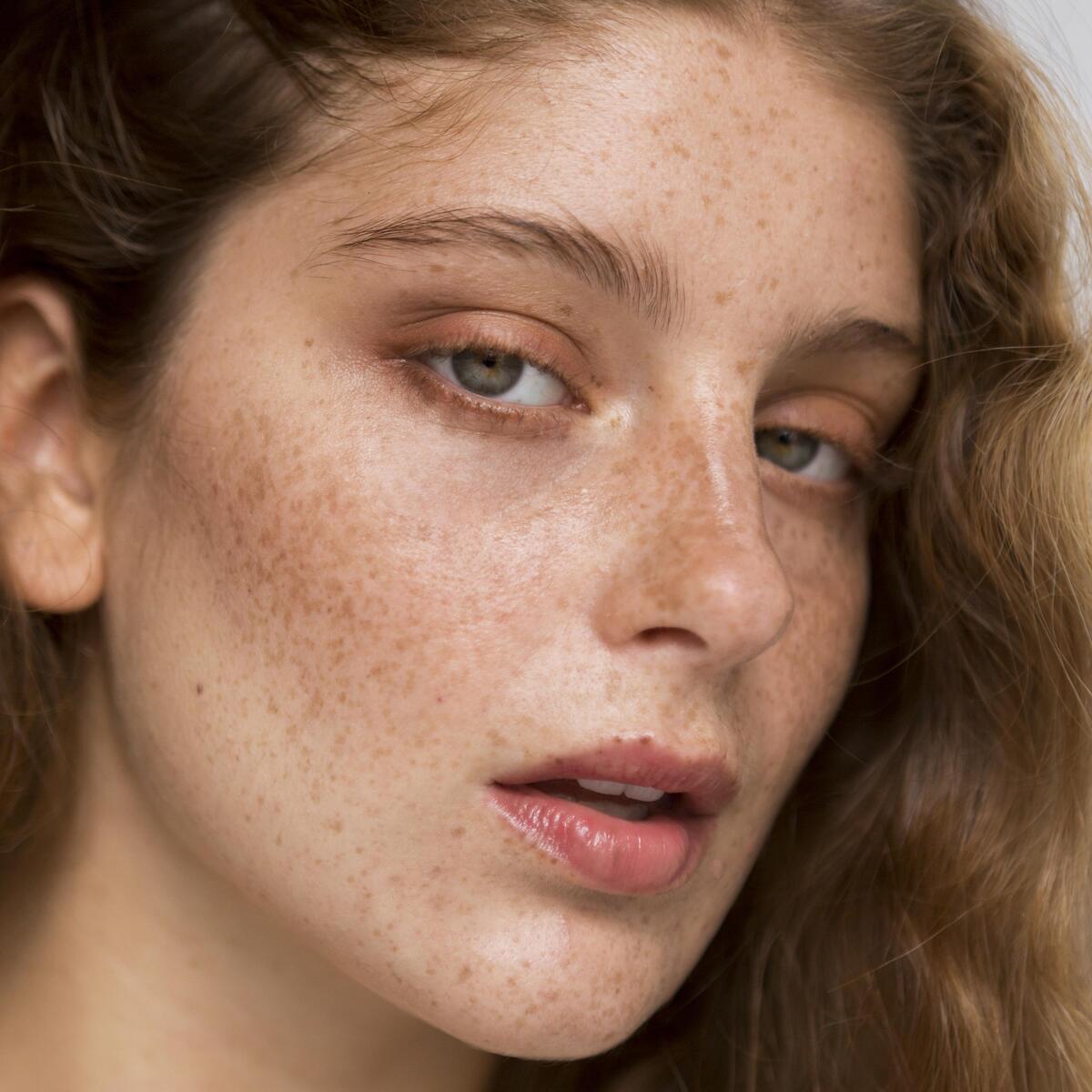 impuretes-de-la-peau